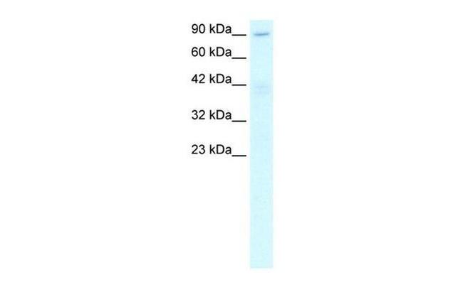 C20orf194 Antibody in Western Blot (WB)