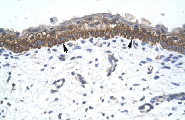 ZNF385A Antibody in Immunohistochemistry (IHC)