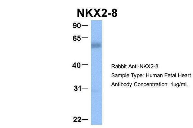 Nkx2.8 Antibody in Western Blot (WB)