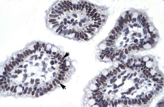 AATF Antibody in Immunohistochemistry (IHC)