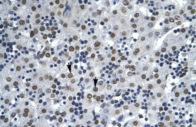 AATF Antibody in Immunohistochemistry (IHC)