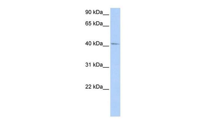 GTF2H4 Antibody in Western Blot (WB)