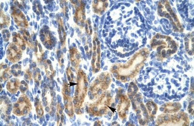 HCLS1 Antibody in Immunohistochemistry (Paraffin) (IHC (P))