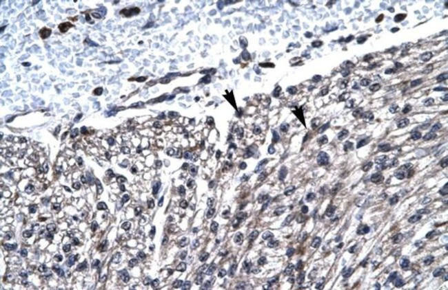 HCLS1 Antibody in Immunohistochemistry (Paraffin) (IHC (P))