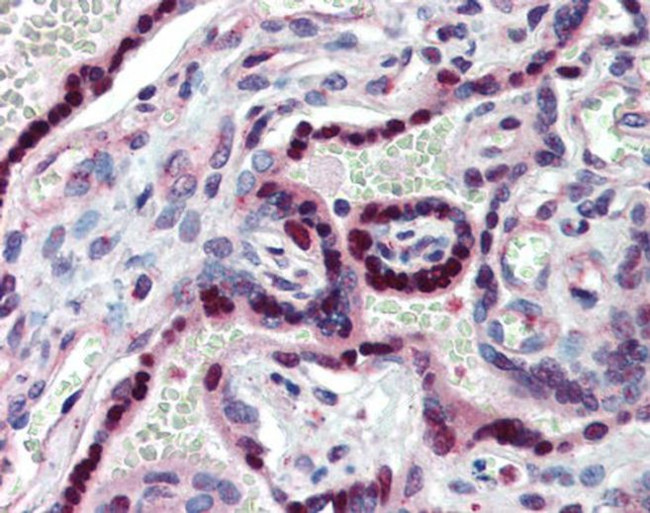 TLX Antibody in Immunohistochemistry (IHC)