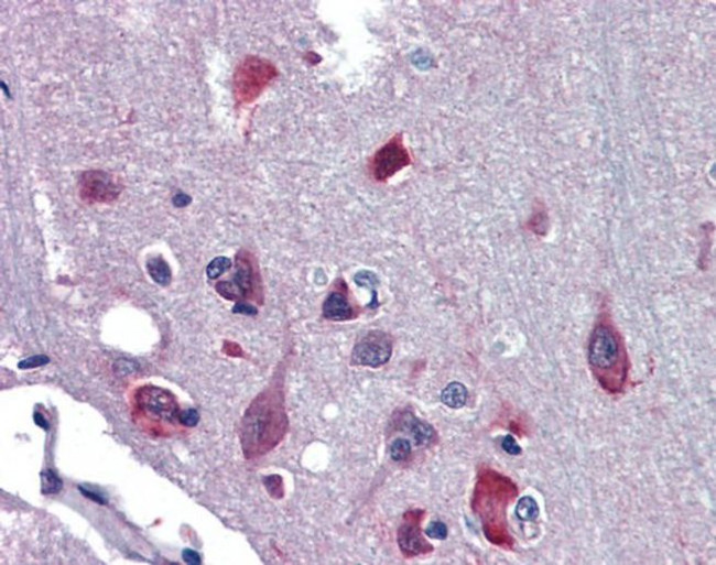 TLX Antibody in Immunohistochemistry (IHC)