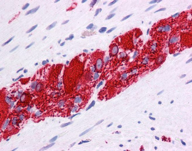 TLX Antibody in Immunohistochemistry (IHC)