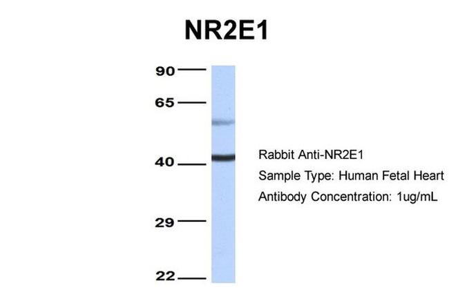 TLX Antibody in Western Blot (WB)