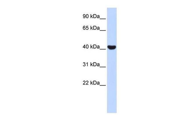 TLX Antibody in Western Blot (WB)