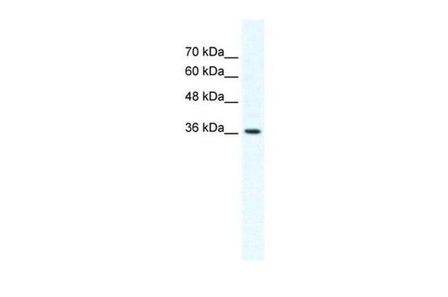 DVL1 Antibody in Western Blot (WB)