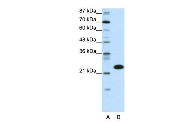 TAF11 Antibody in Western Blot (WB)