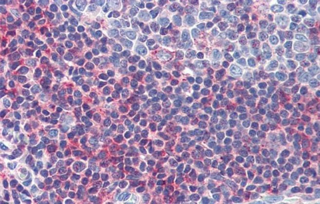 GSC Antibody in Immunohistochemistry (IHC)