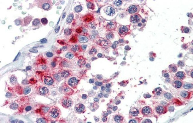 GSC Antibody in Immunohistochemistry (IHC)