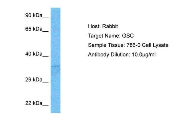 GSC Antibody in Western Blot (WB)