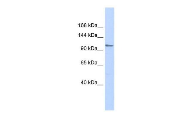 ZFPM1 Antibody in Western Blot (WB)