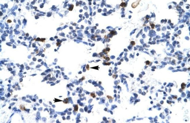 E2F6 Antibody in Immunohistochemistry (IHC)