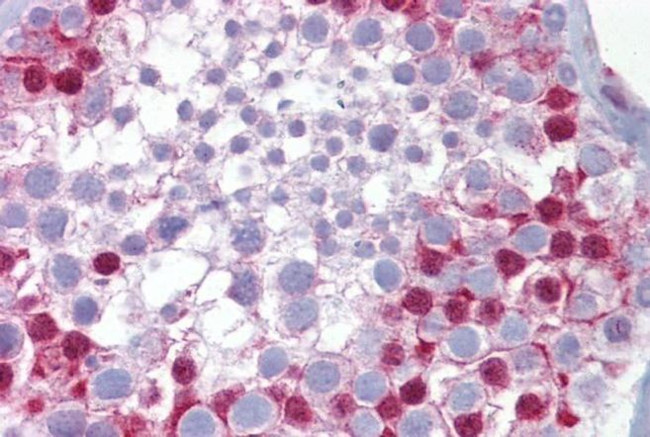 SP7 Antibody in Immunohistochemistry (IHC)