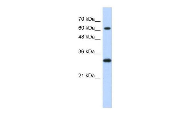 ERF Antibody in Western Blot (WB)