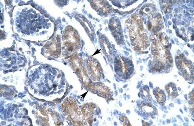 FOXF1 Antibody in Immunohistochemistry (IHC)