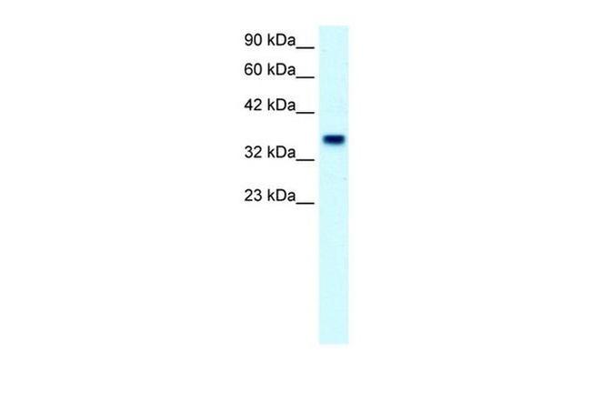 FOXF1 Antibody in Western Blot (WB)