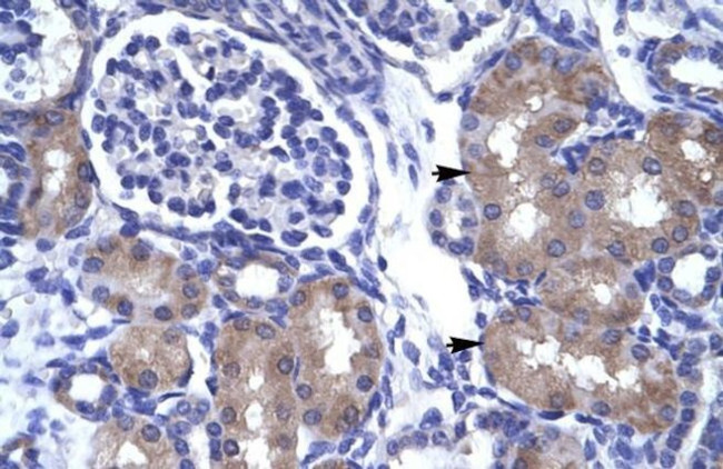 ASCL1 Antibody in Immunohistochemistry (IHC)