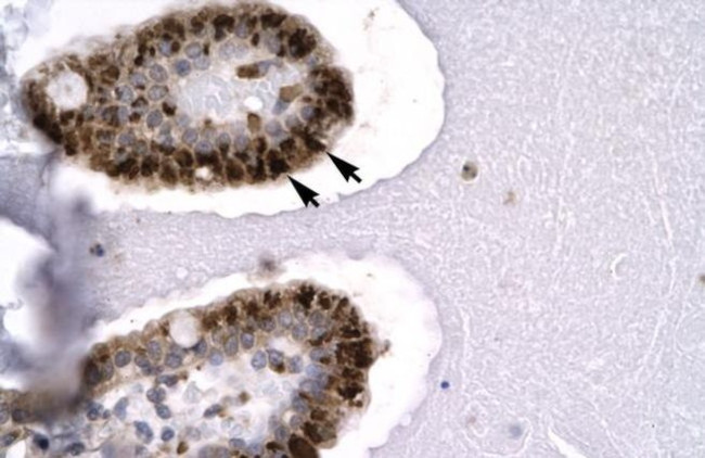 SIRT5 Antibody in Immunohistochemistry (IHC)