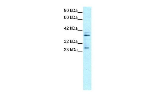 SIRT5 Antibody in Western Blot (WB)