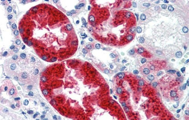 EYA1 Antibody in Immunohistochemistry (IHC)