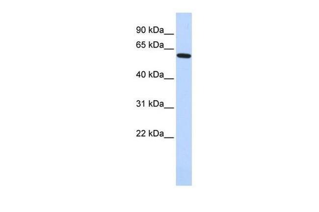 EYA1 Antibody in Western Blot (WB)