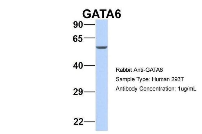GATA6 Antibody in Western Blot (WB)