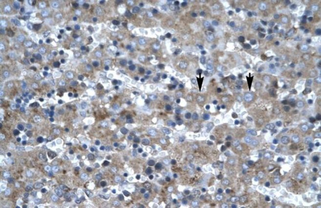 LHX6 Antibody in Immunohistochemistry (Paraffin) (IHC (P))