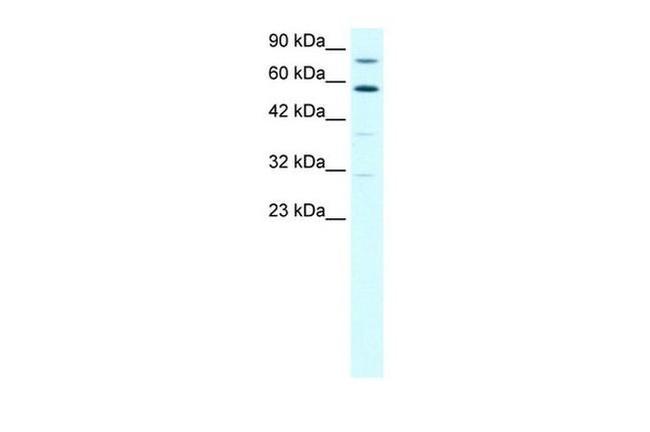 SND1 Antibody in Western Blot (WB)