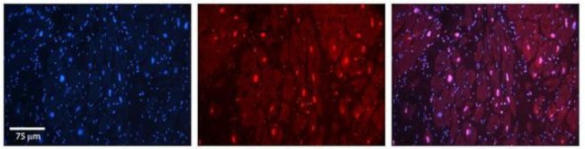 HIPK2 Antibody in Immunohistochemistry (Paraffin) (IHC (P))