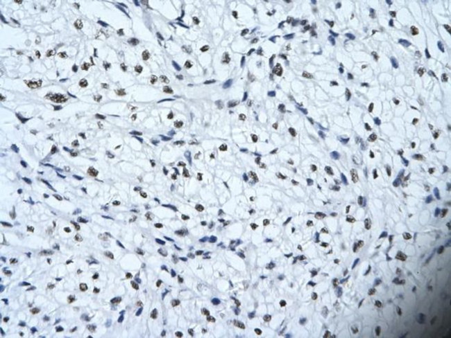 HIPK2 Antibody in Immunohistochemistry (Paraffin) (IHC (P))