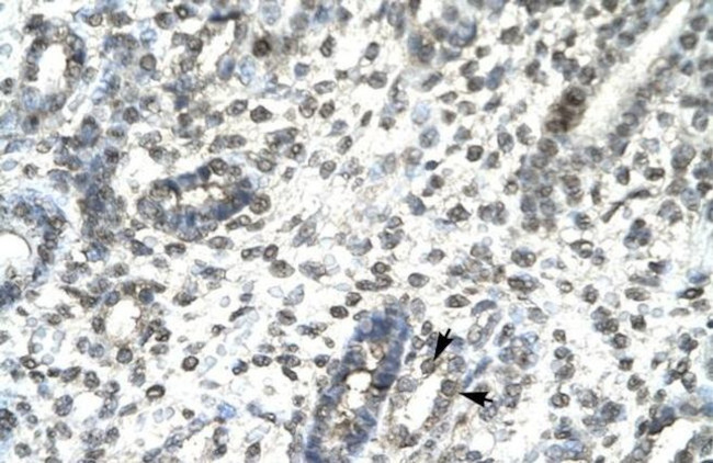 T-bet Antibody in Immunohistochemistry (IHC)