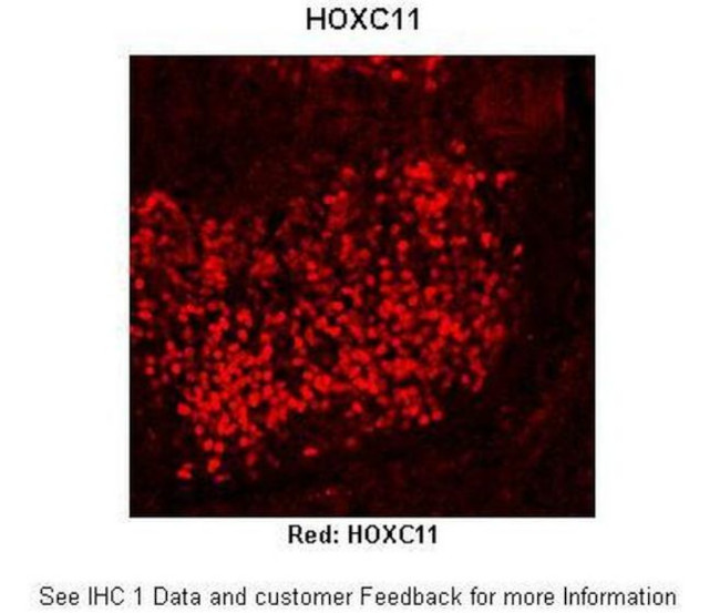 HOXC11 Antibody in Immunohistochemistry (IHC)