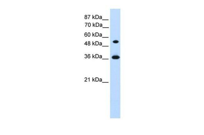 HOXC11 Antibody in Western Blot (WB)