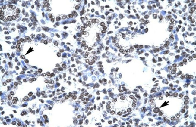 CITED1 Antibody in Immunohistochemistry (IHC)