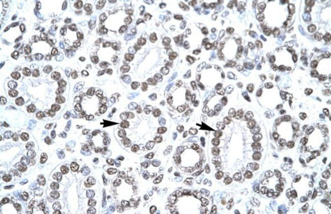 CITED1 Antibody in Immunohistochemistry (IHC)
