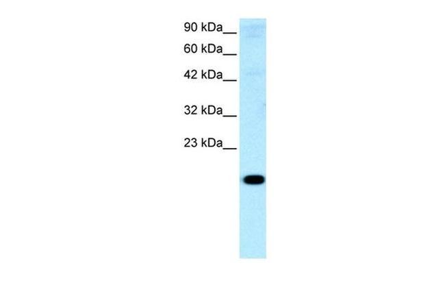 CITED1 Antibody in Western Blot (WB)