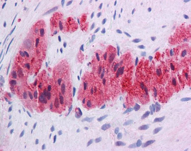 KLF2 Antibody in Immunohistochemistry (IHC)