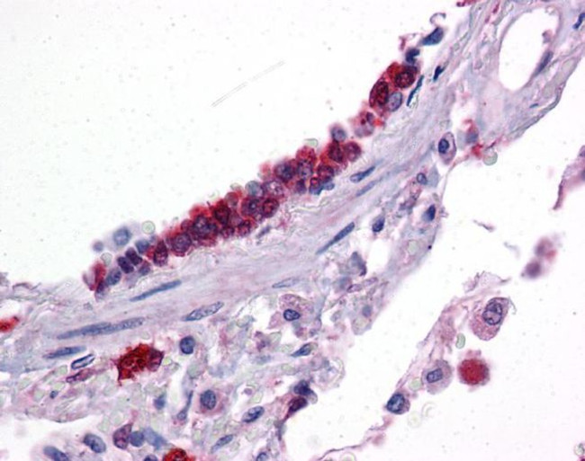 KLF2 Antibody in Immunohistochemistry (IHC)