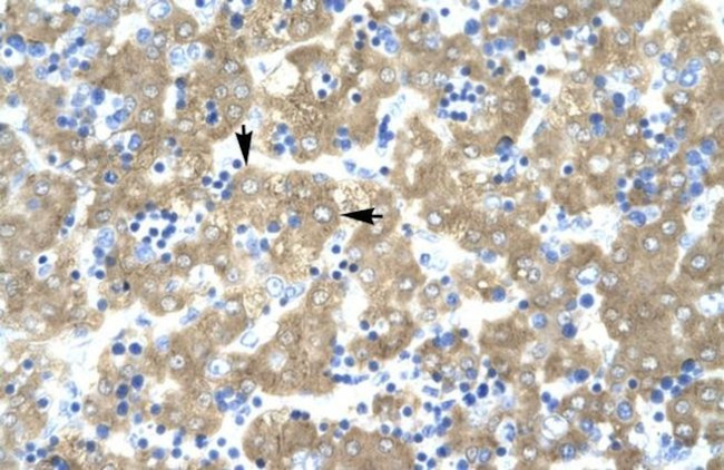 ACAT2 Antibody in Immunohistochemistry (IHC)