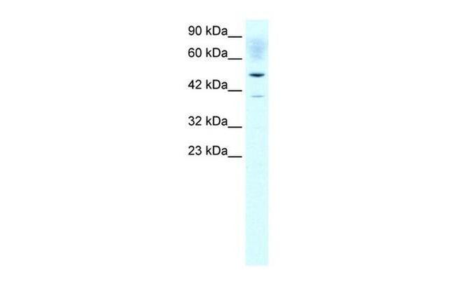 ACAT2 Antibody in Western Blot (WB)