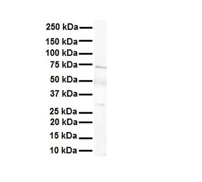 LBX1 Antibody in Western Blot (WB)