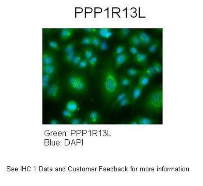 PPP1R13L Antibody in Immunocytochemistry (ICC/IF)