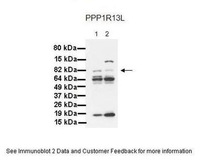 PPP1R13L Antibody in Western Blot (WB)