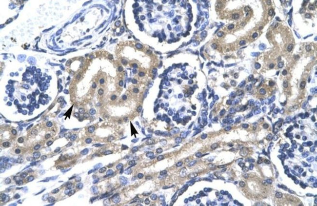 TRAFD1 Antibody in Immunohistochemistry (IHC)