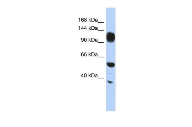 WDHD1 Antibody in Western Blot (WB)