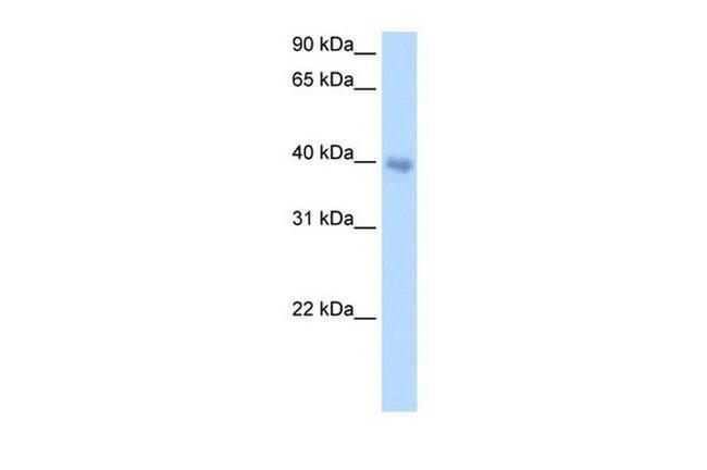 DLX5 Antibody in Western Blot (WB)